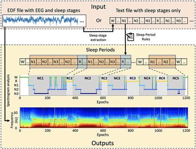 SSAVE: A tool for analysis and visualization of sleep periods using electroencephalography data